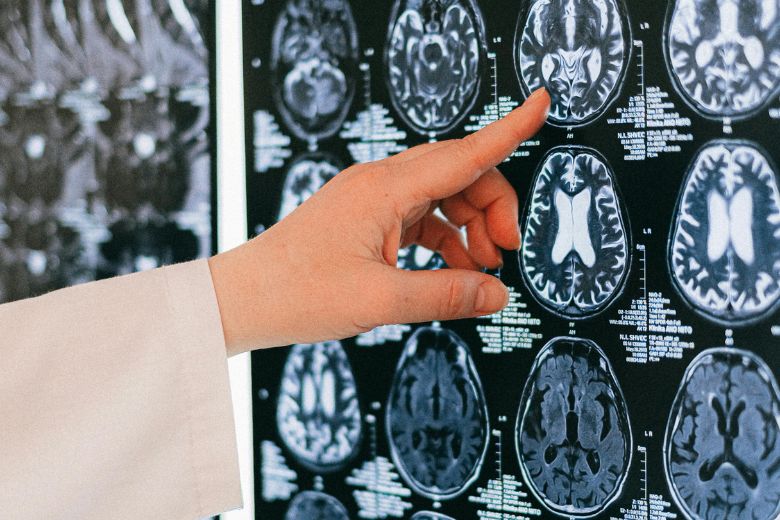 自閉症スペクトラム以外の発達障害