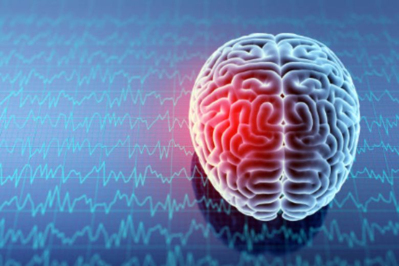 脳の画像