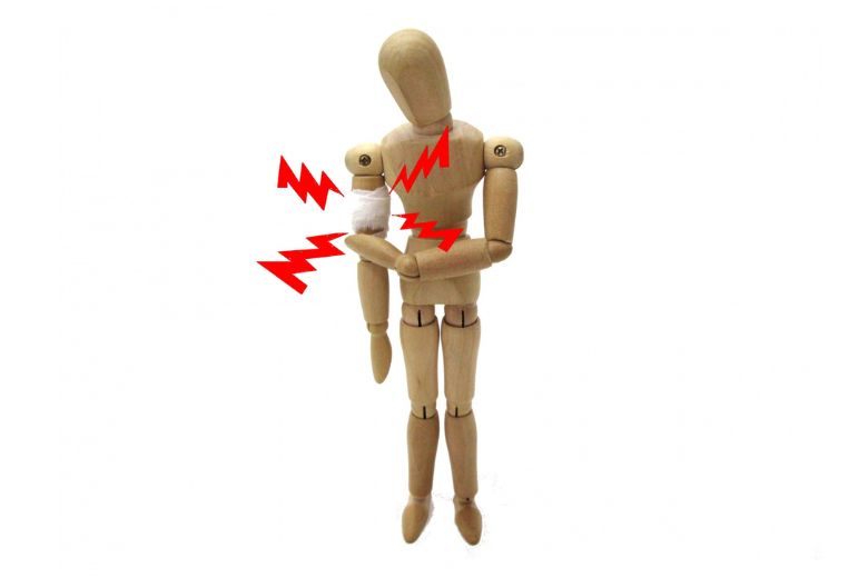 骨折の痛み画像