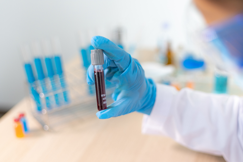 リアルタイムの栄養評価：Rapid Turnover Protein