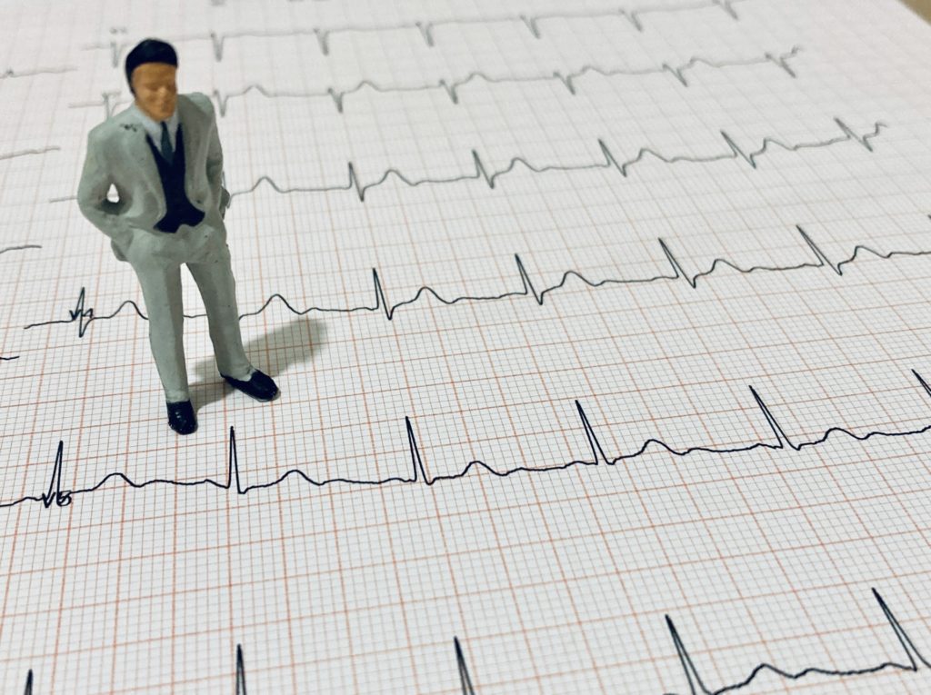 心房細動の診断：心電図の役割