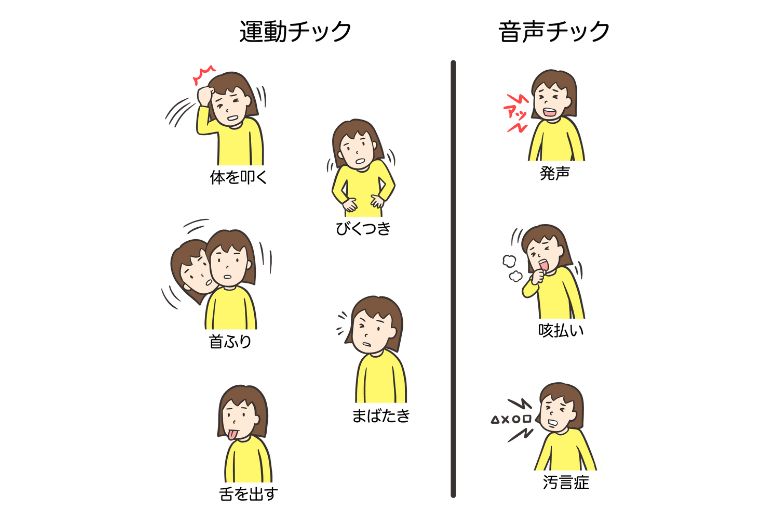 チック症のイラスト