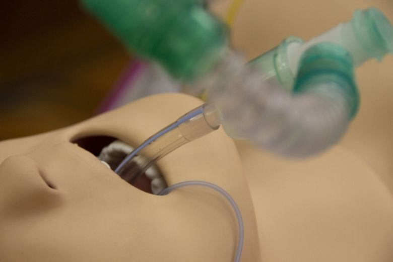 気管内挿管とは