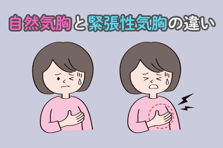 自然気胸と緊張性気胸の違い