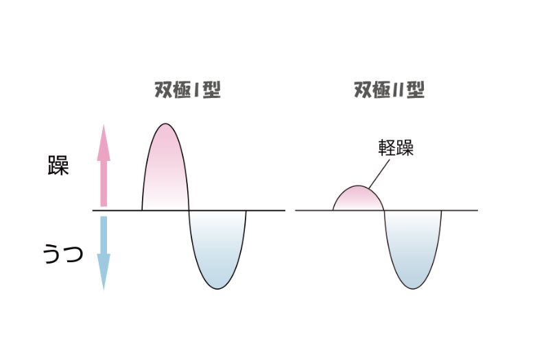 双極性障害のタイプ