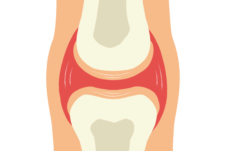 赤ちゃんの骨は軟骨から始まる