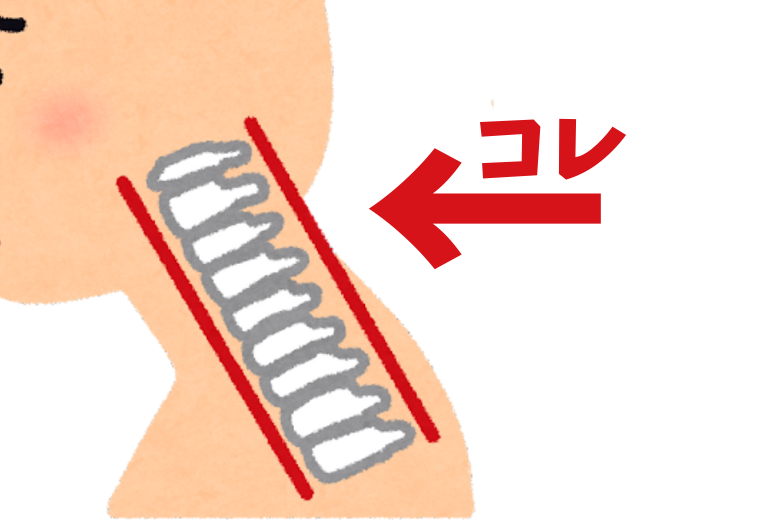 ストレートネックとは
