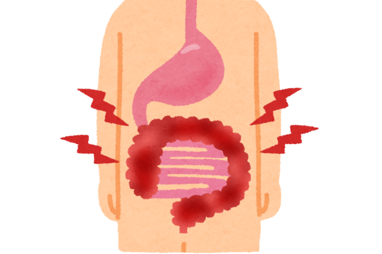 ■ 大腸がんでも同様の傾向が