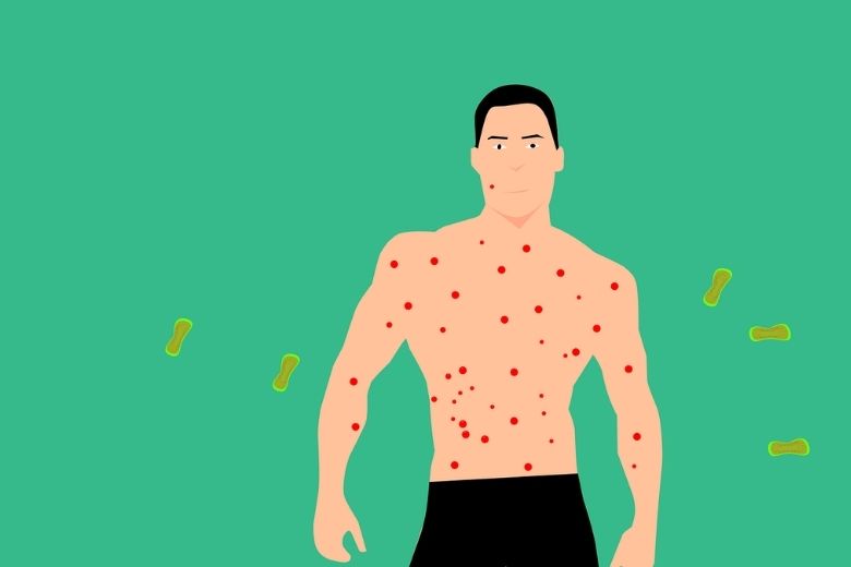 2. 帯状疱疹とがんの関係