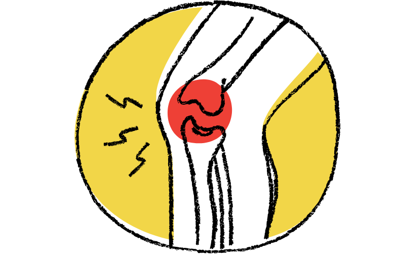 ジャンパー膝（膝蓋腱炎）