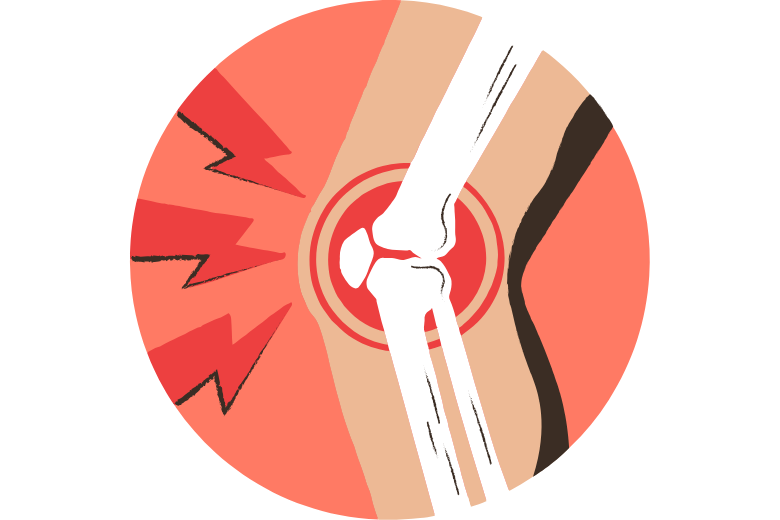 ■ 蝶番関節 ― 一方向にだけ動く安定した関節