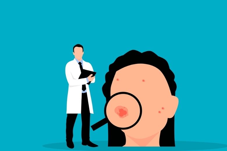 皮膚症状が示すサインを見逃さないために