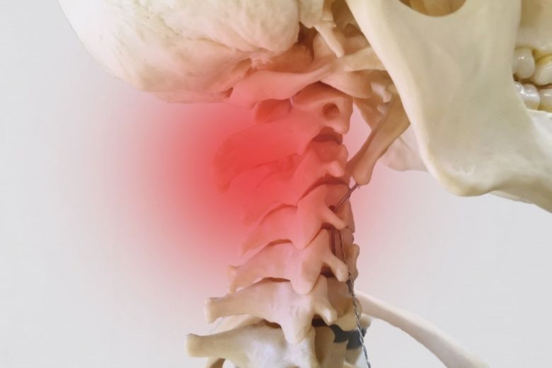 3. 肩こりの原因は何か？