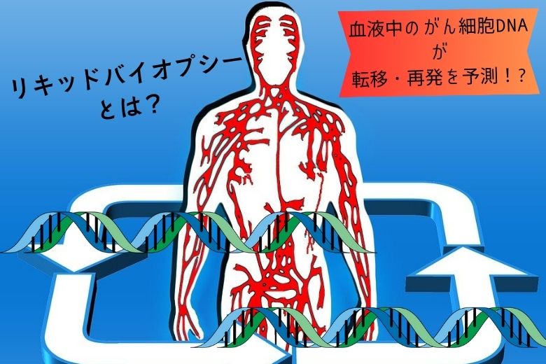 血液中のがん細胞DNAが転移・再発を予測する！リキッドバイオプシーによる循環腫瘍DNAの解析
