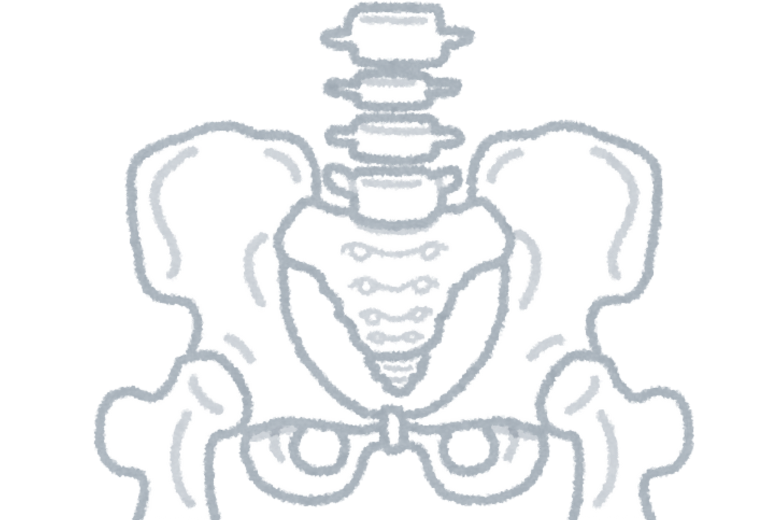 ■ 発育性股関節形成不全(DDH)