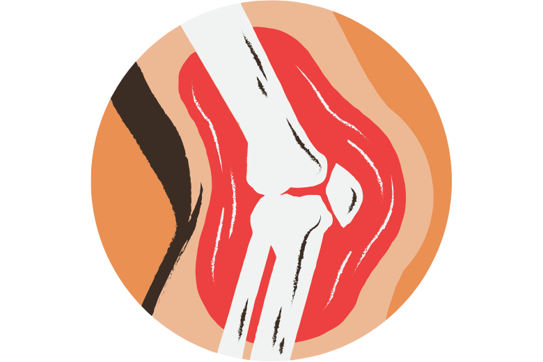 ■ 膝の重要な4つの靭帯