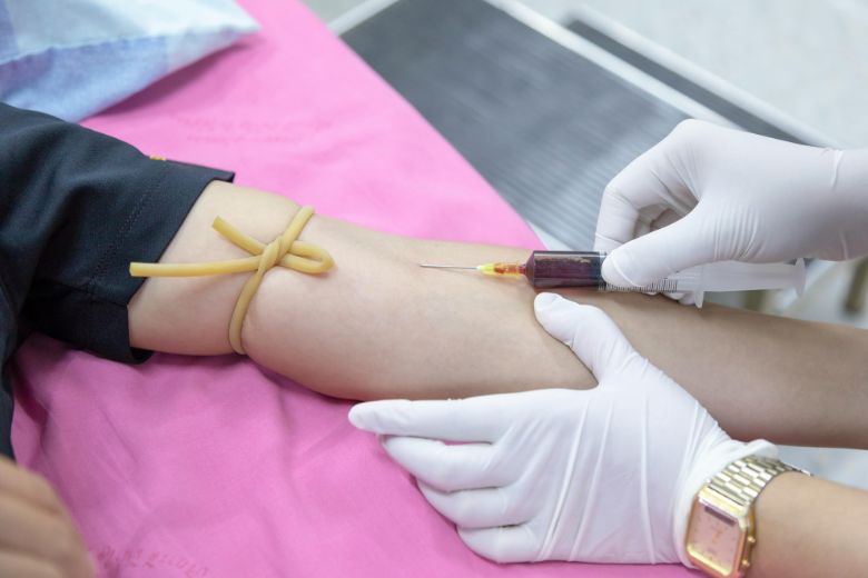 2. すい臓がんに特徴的な「間質」とヒアルロン酸の問題