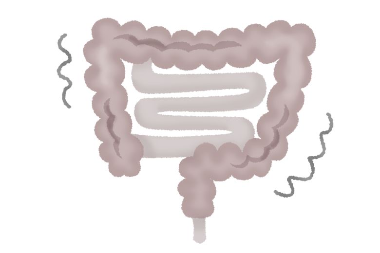 大腸がんステージ4では手術が不要になるのか
― 日本で実施された前向き臨床試験「JCOG1007／iPACS」から見える新たな標準治療 ―